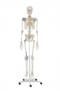 Skelett mit Bandapparat Otto