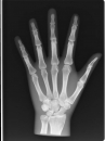 Röntgenphantom Hand opak