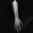 Röntgenphantom Unterarm opak