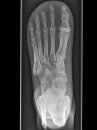 Röntgenphantom Fuß opak