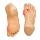 Häufige Fußprobleme R10035 