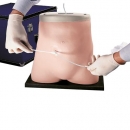 Peritonealdialysesimulator - Für die kontinuierliche ambulante Peritonealdialyse