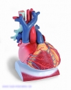 Herz auf Zwerchfell, 3-fache Größe, 10-teilig