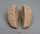 Menschliches Gehirn Naturabguss