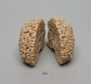 Menschliches Gehirn Naturabguss