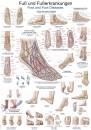 Lehrtafel Fuß und Fußerkrankungen AL528 